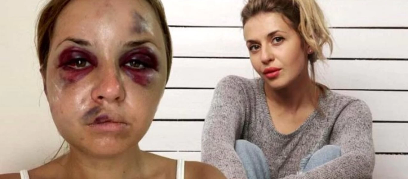 Τρόμος για Ουκρανή παρουσιάστρια: 45χρονος την ξυλοκόπησε και προσπάθησε να τη βιάσει μπροστά στον γιο της (φώτο)